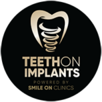 Teeth-On-Implants-Logo-Website-200px